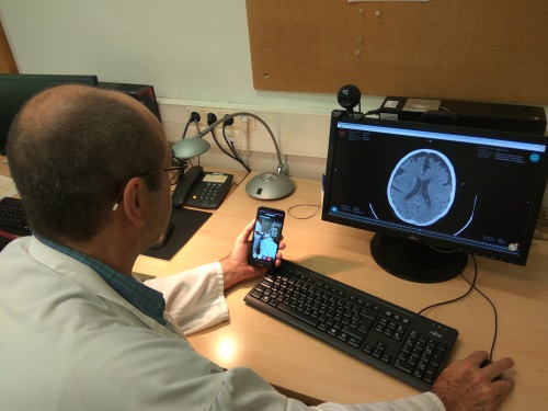 El neuròleg del Trueta fa un teleictus.