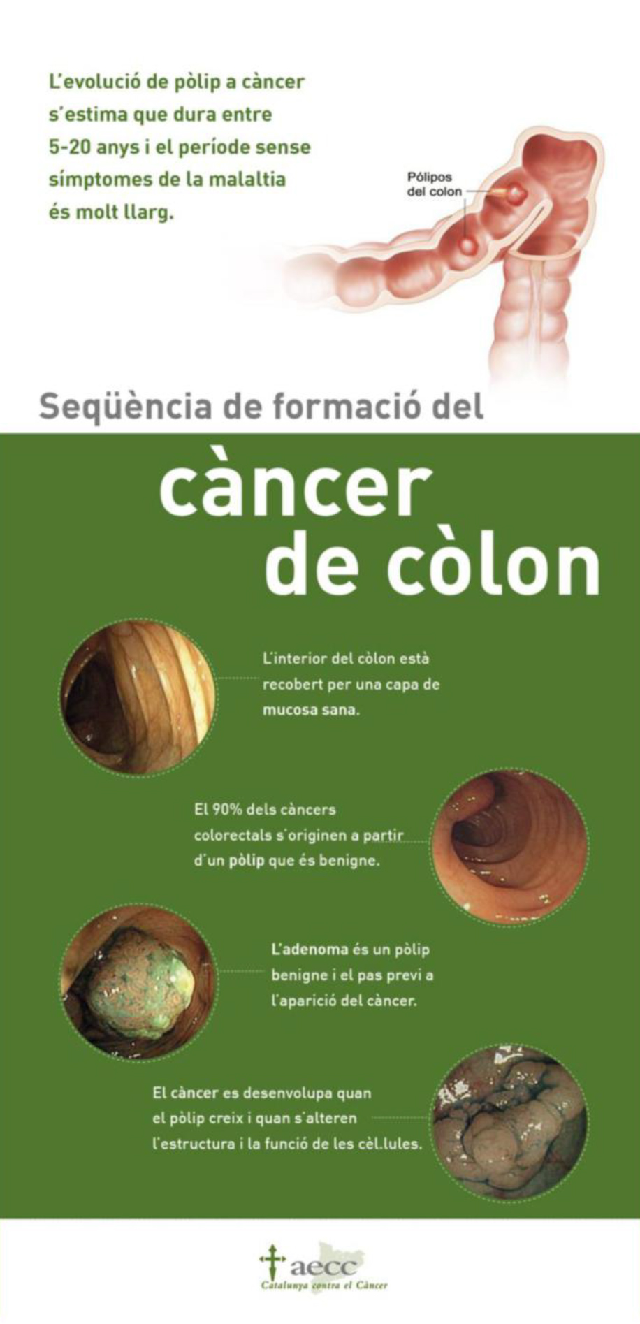 Diapositiva del Programa de Cribratge de Càncer de Còlon i Recte