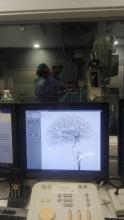 Professionals fent una angiografia cerebral.